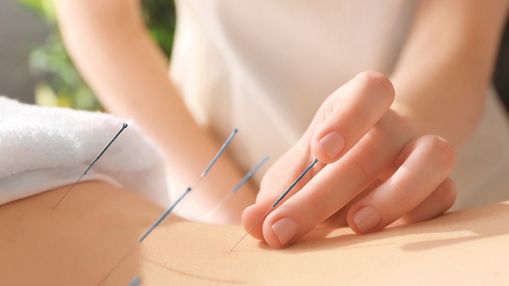 Acupuncture & Acupressure